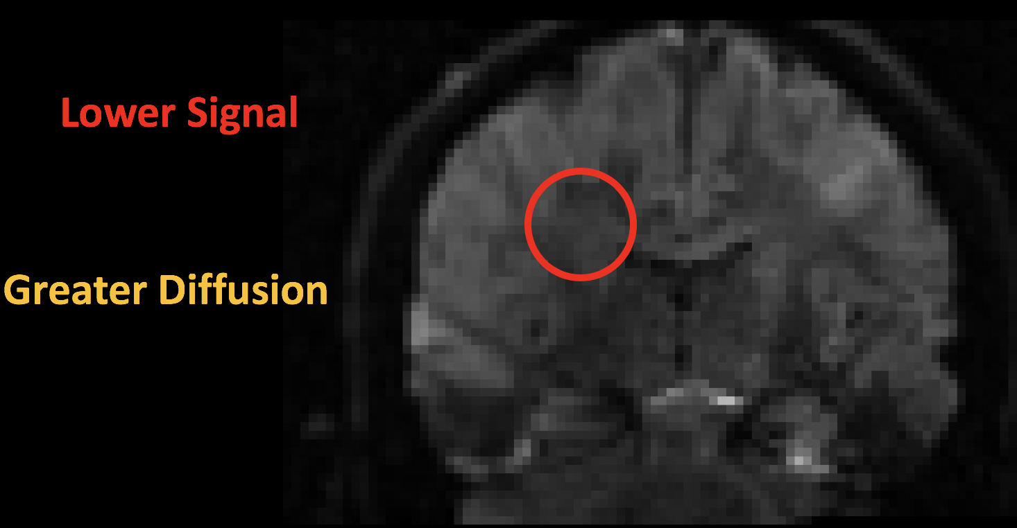 ../../_images/00_Signal_Diffusion.png