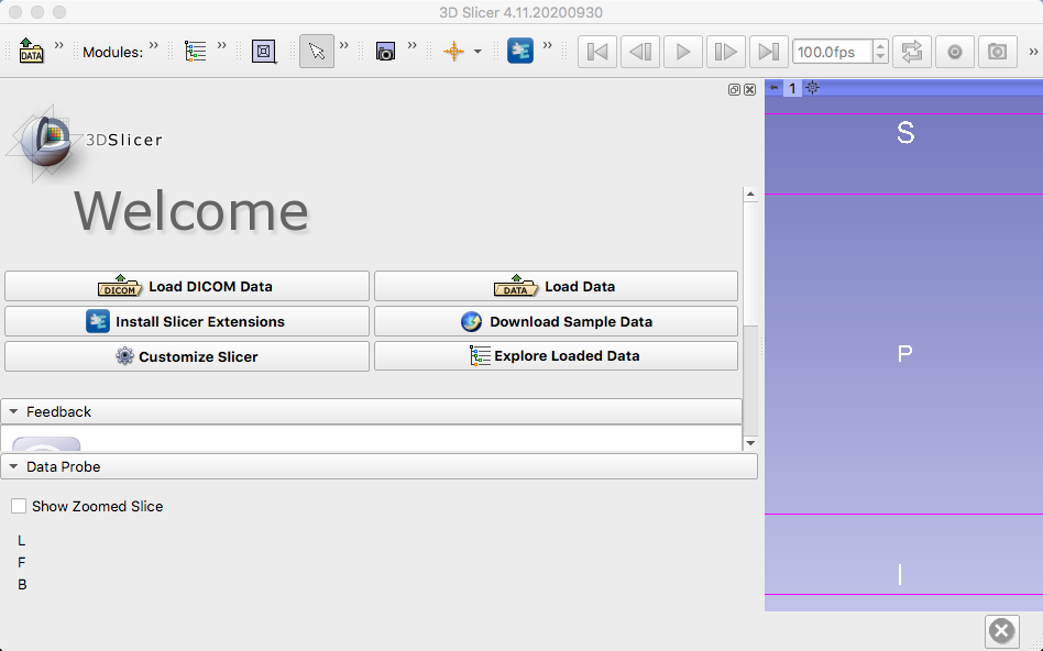 ../../_images/00_Slicer_GUI.png