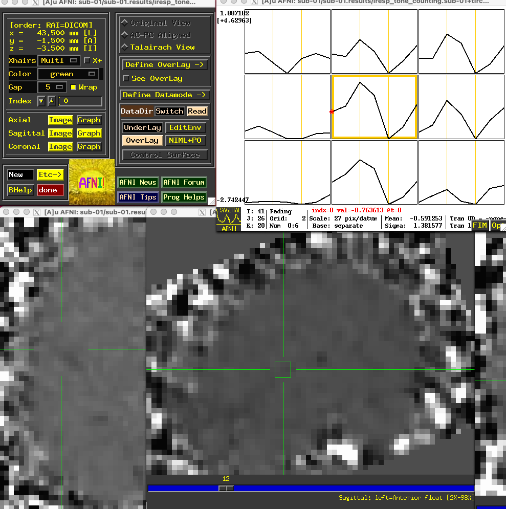 ../../_images/01_FIR_AFNI_Plot.png