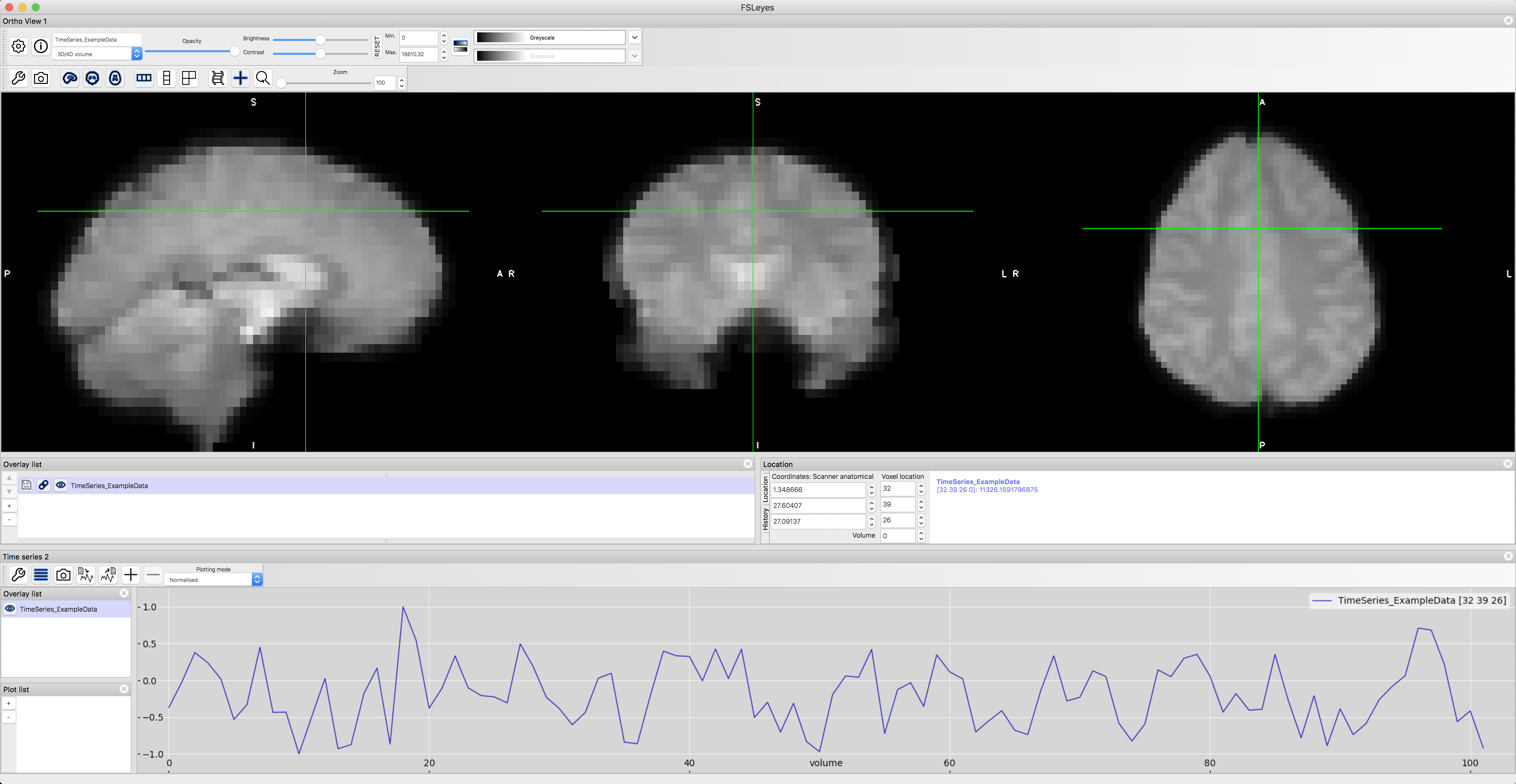 ../../_images/01_FSL_Timeseries.png