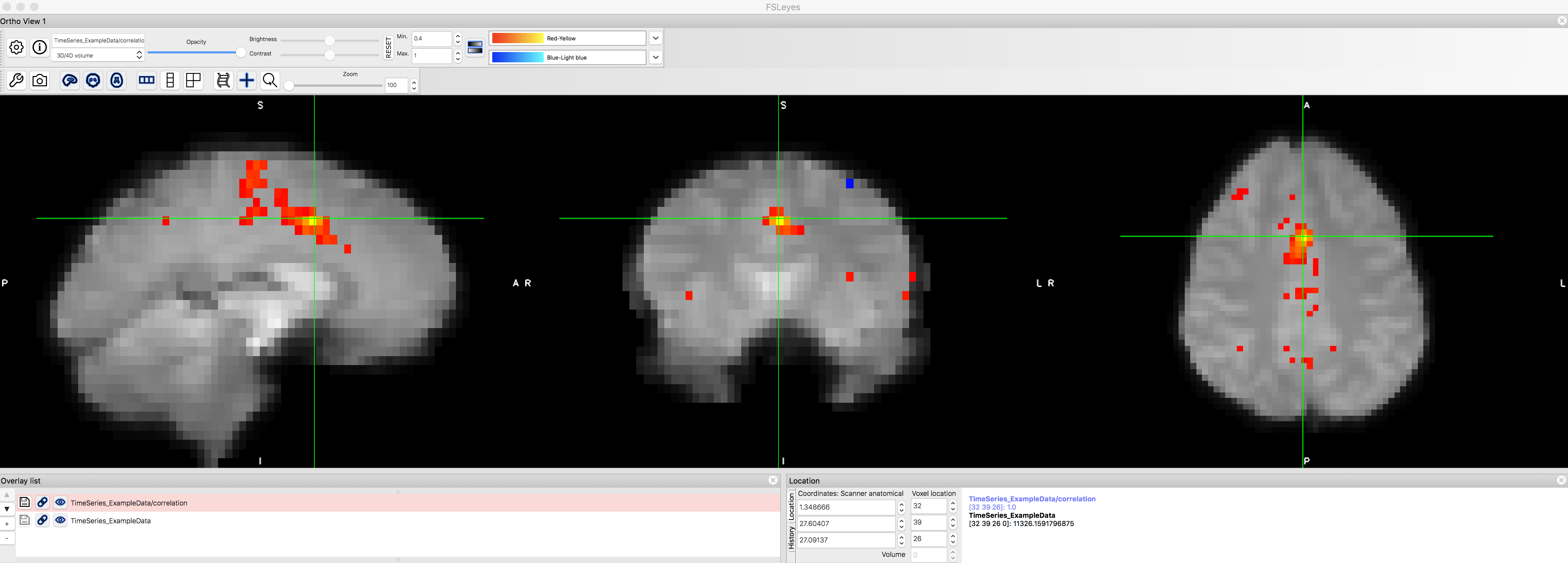 ../../_images/01_FSL_dACC_Corr.png
