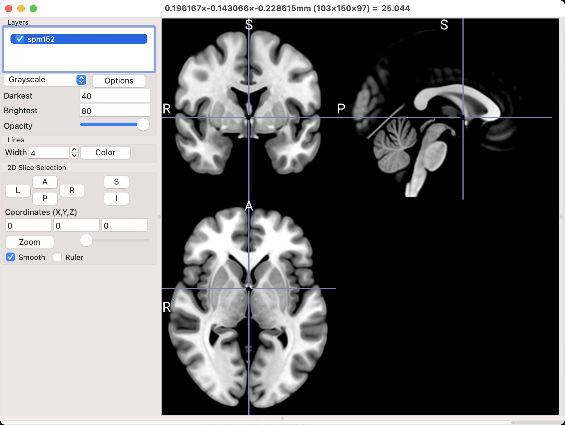 ../_images/01_MRIcroGL_spm152.png