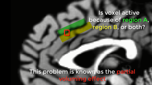 ../../_images/01_PartialVoluming.png