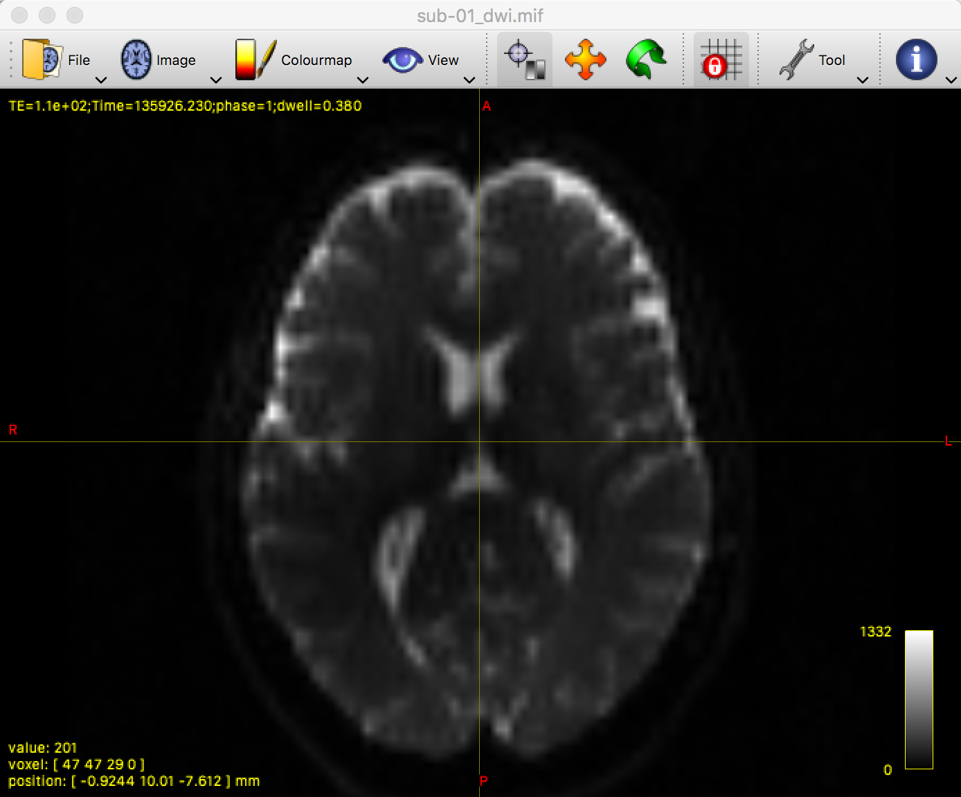 ../../_images/01_SampleImage.png