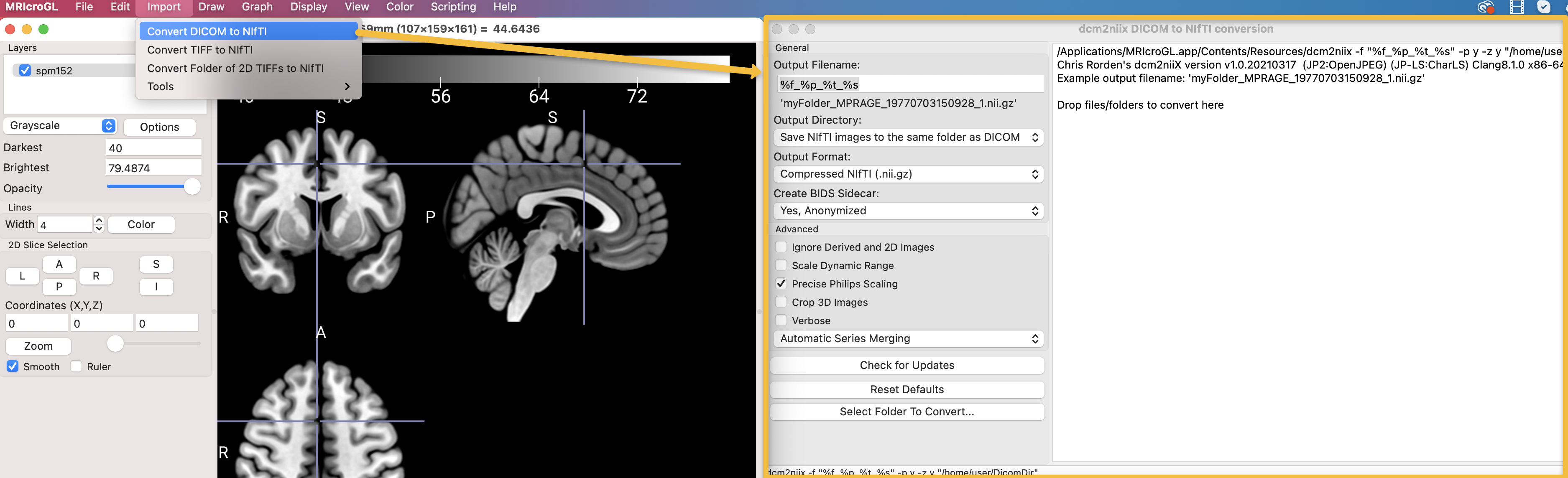 ../_images/02_DICOMtoNIFTI_GUI.png