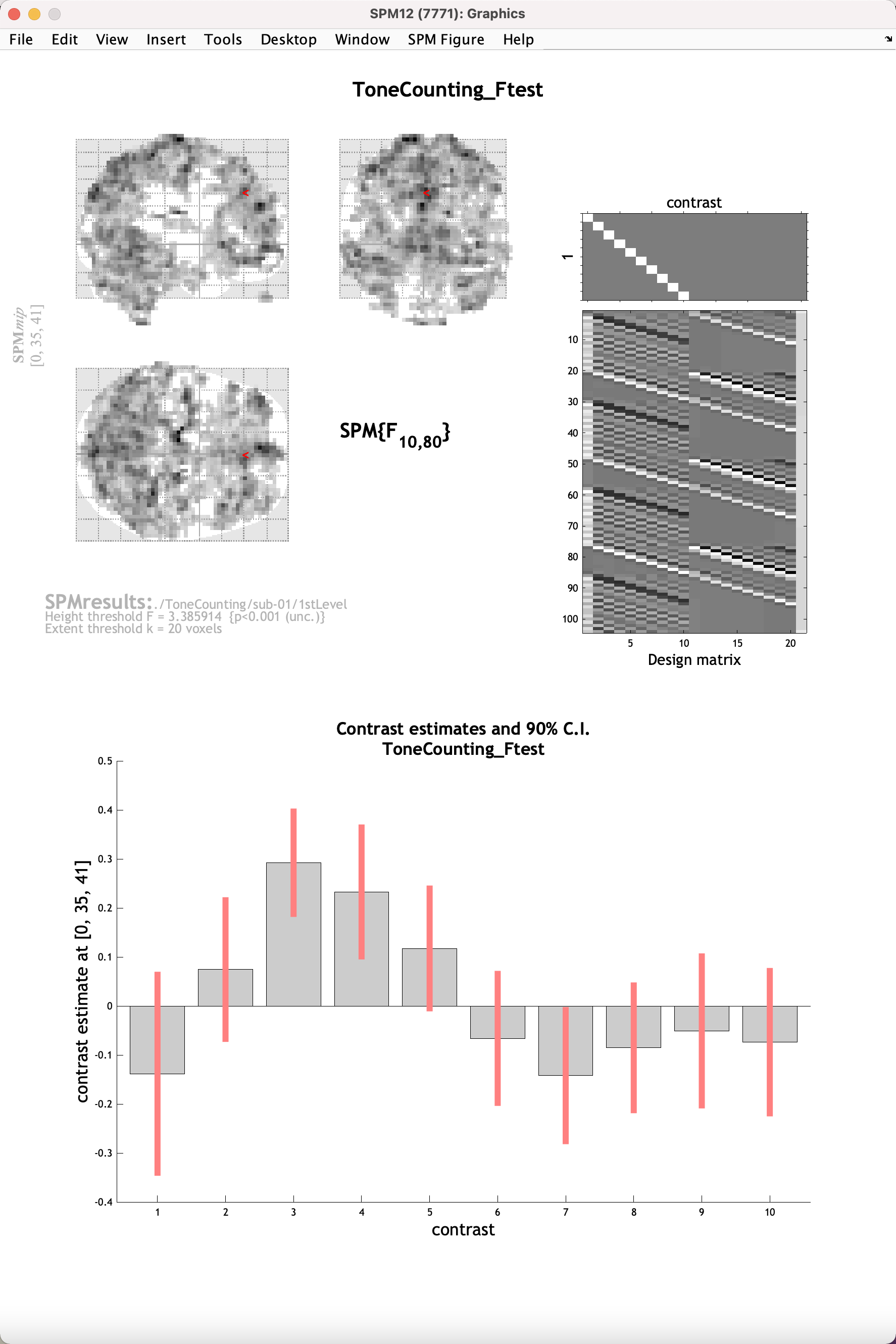 ../../_images/02_SPM_FIR_Plot.png