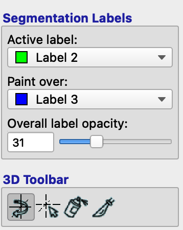 ../../_images/02_SegmentationLabels.png