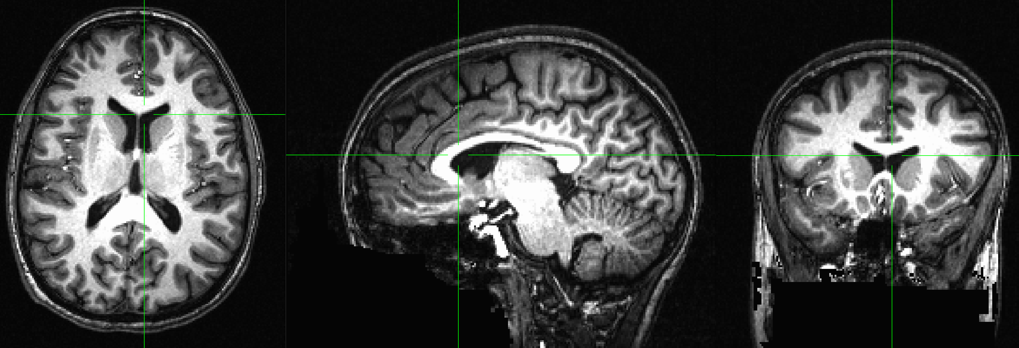 ../../_images/03_Anatomical_Inspection.png