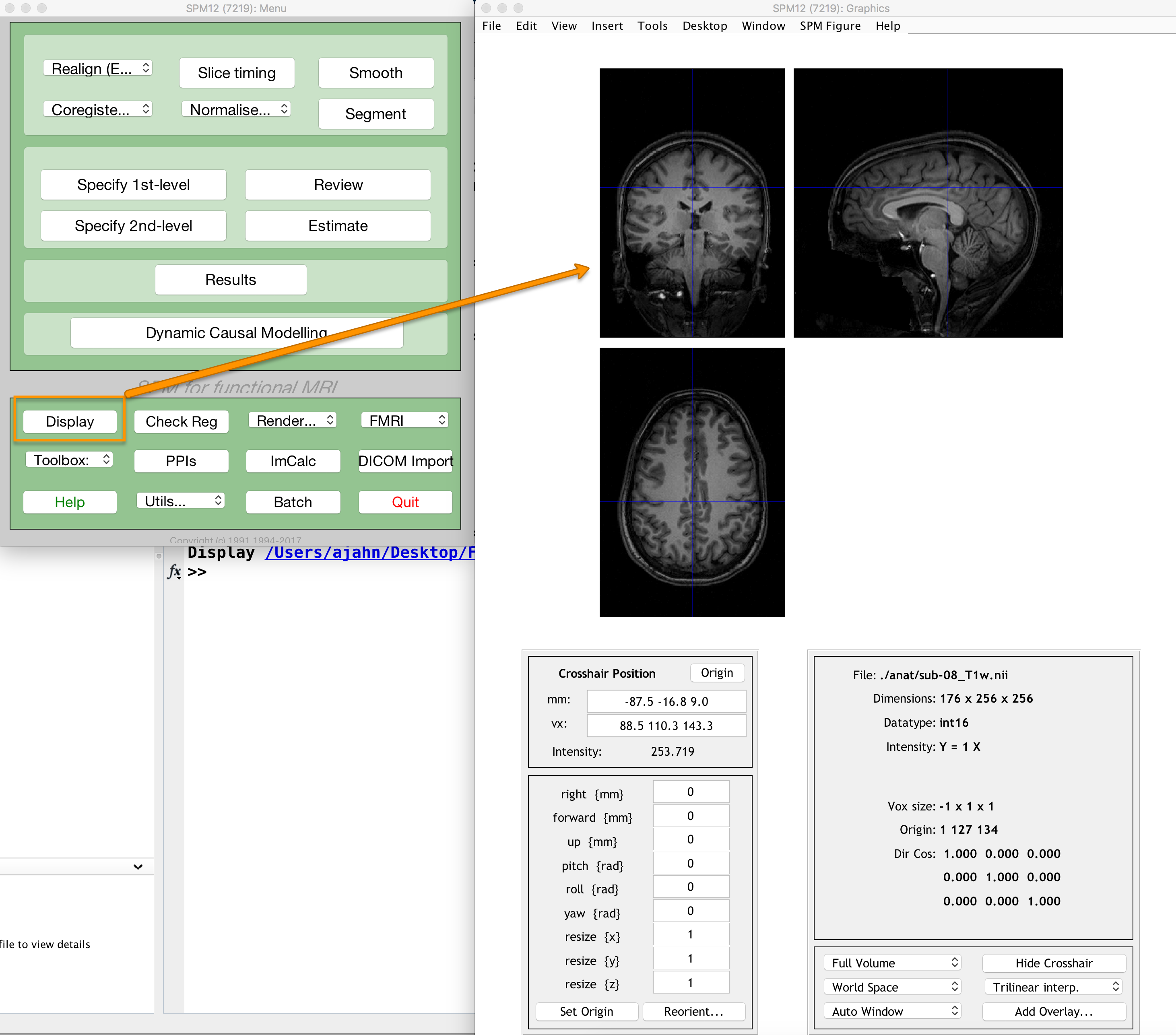 ../../_images/03_Anatomical_Inspection1.png