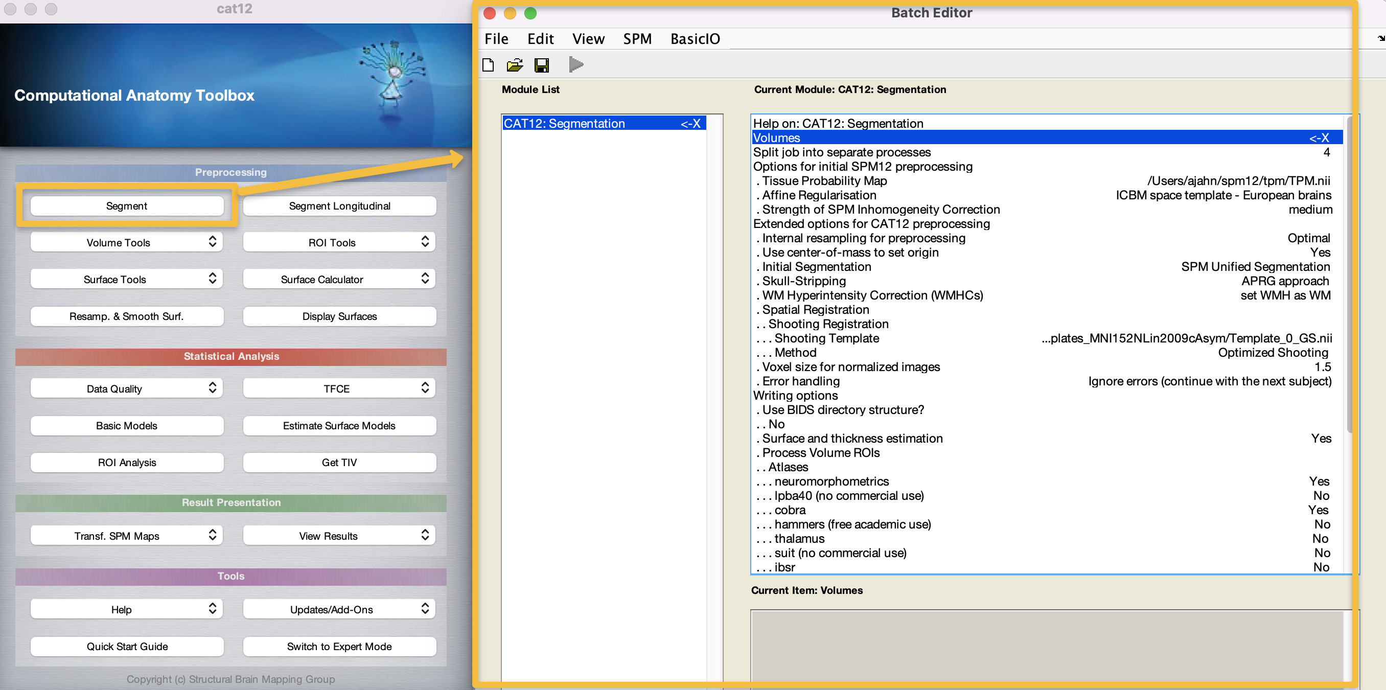 ../_images/03_CAT12_Segmentation_Window.png