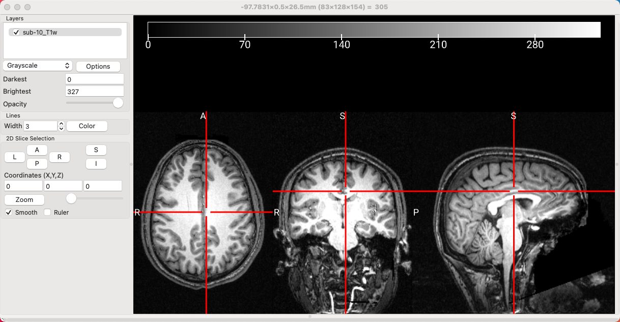../_images/03_LoadAnatomical.png
