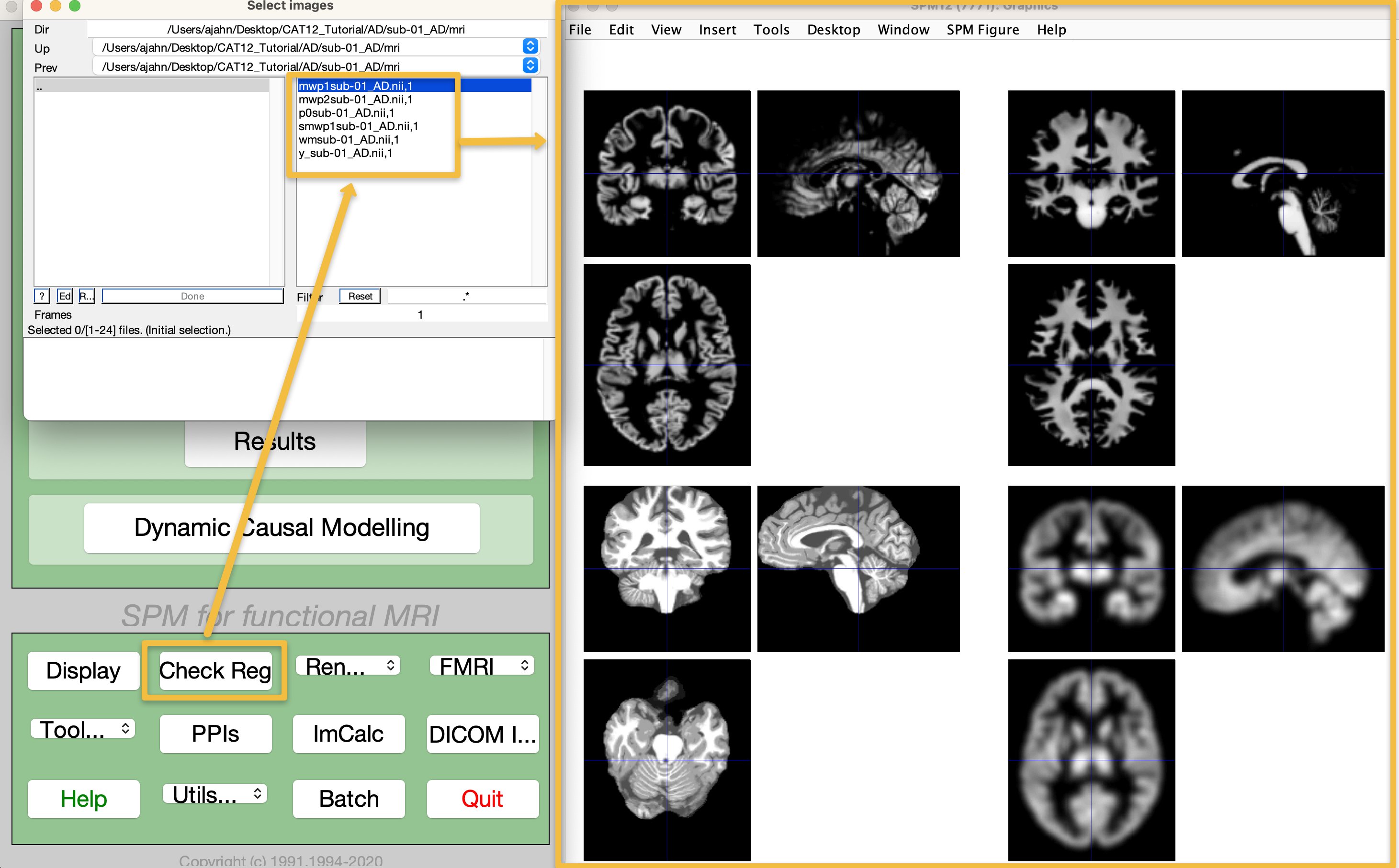 ../_images/03_View_MRI_Output.png