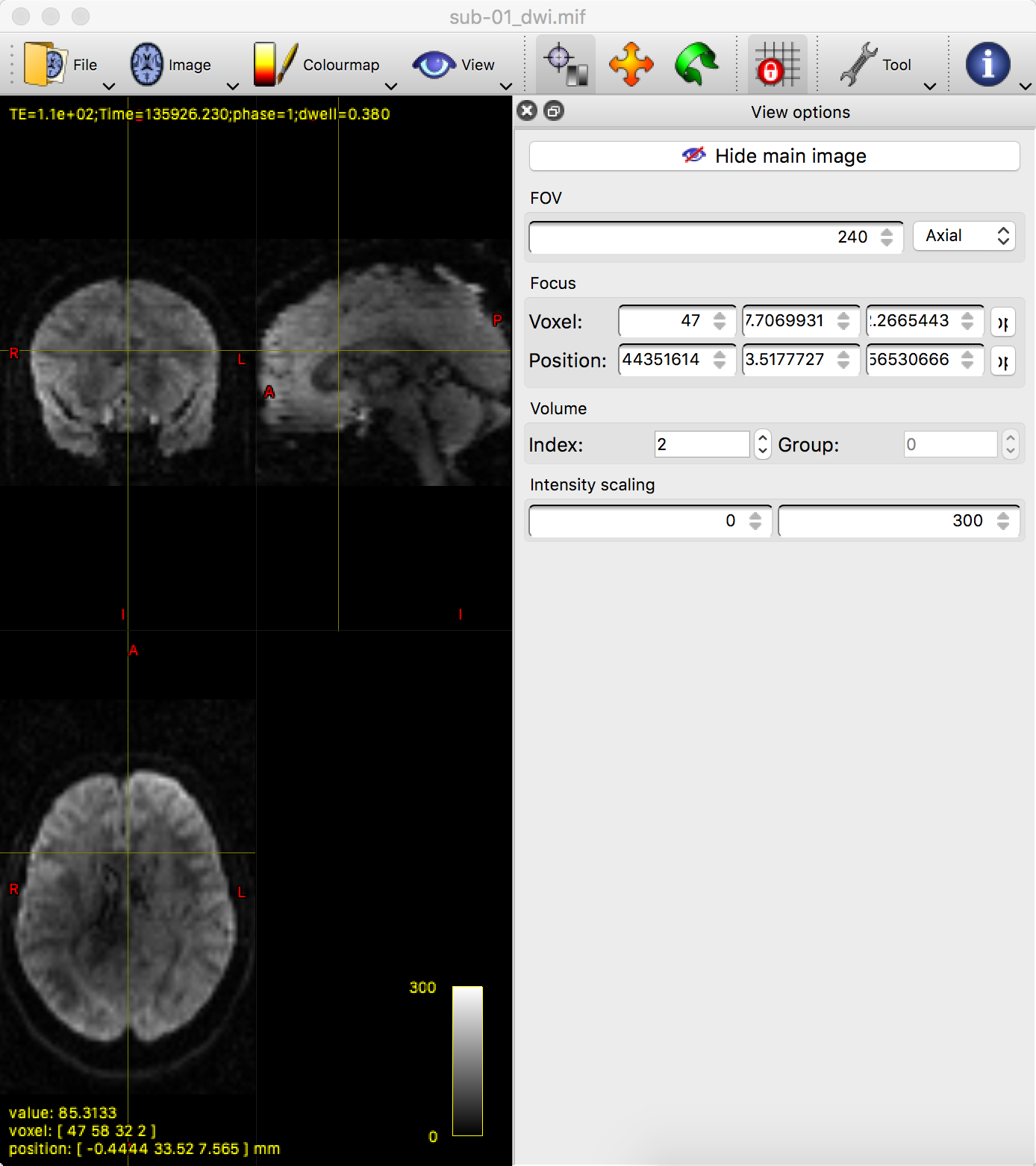 ../../_images/03_mrview_IntensityScaling.png