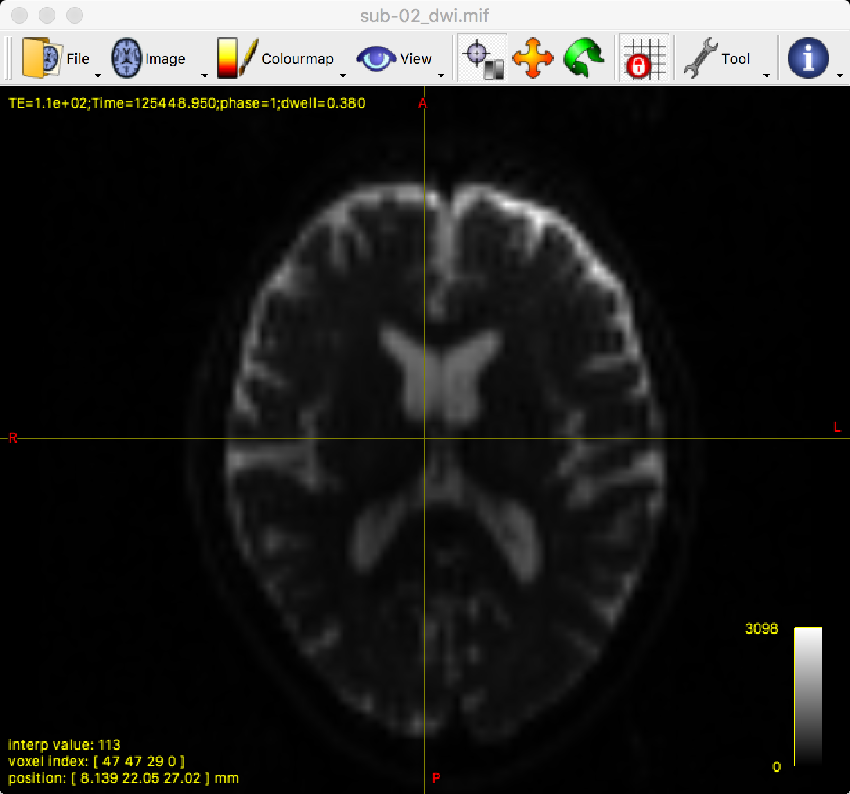 ../../_images/03_mrview_axial.png