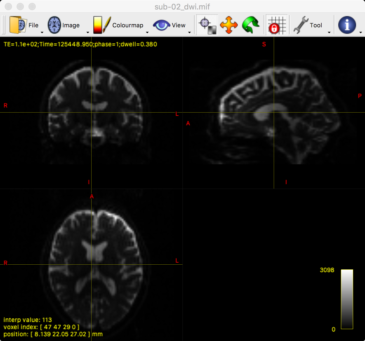 ../../_images/03_mrview_ortho.png