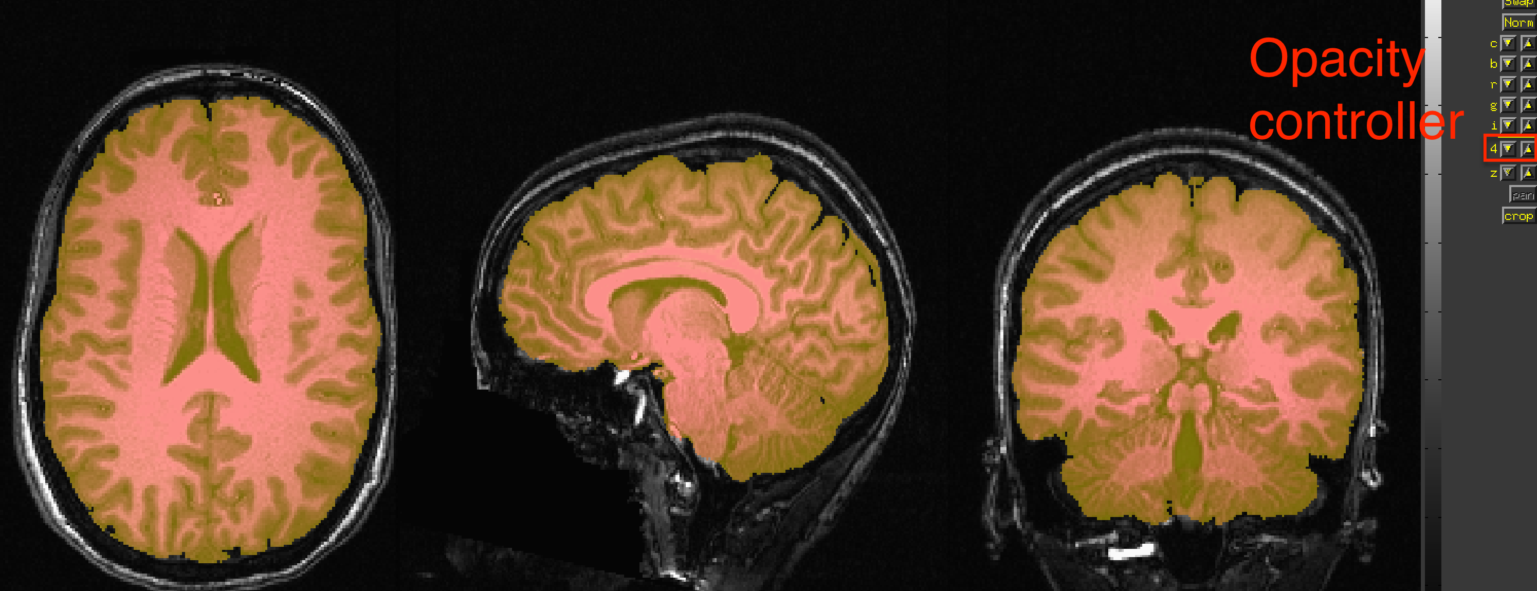 ../../../_images/04_01_SkullStrip_overlay.png