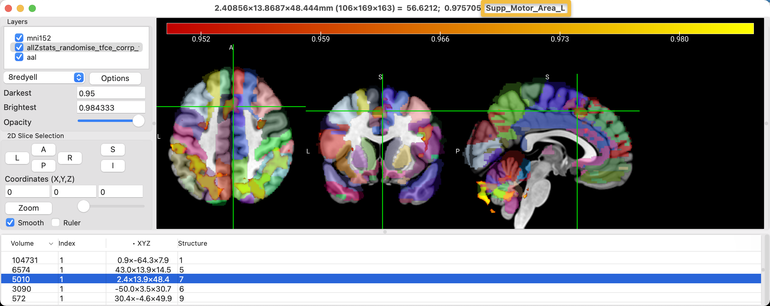 ../_images/04_AAL.png