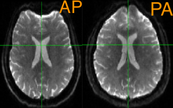 ../../_images/04_AP_PA_Comparisons.png