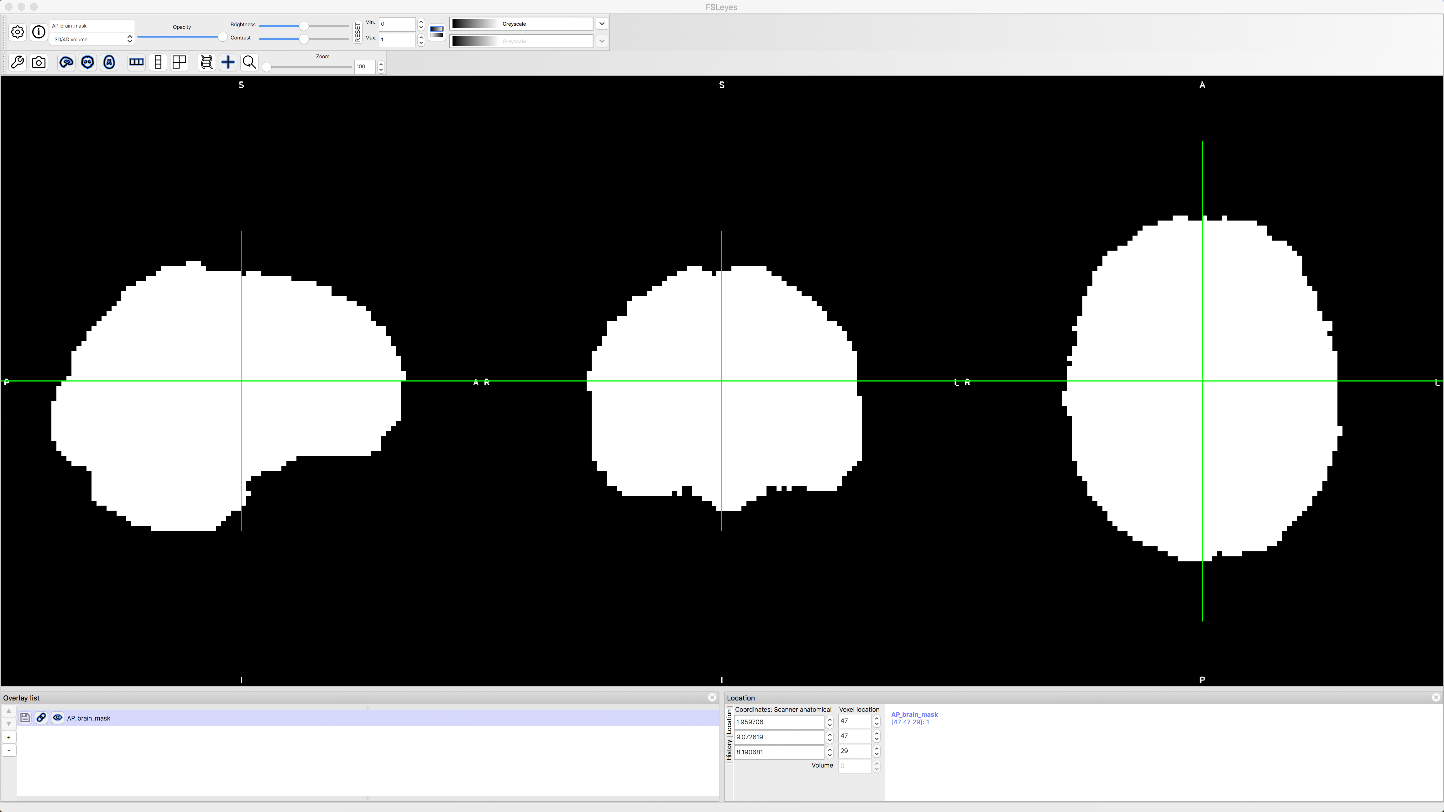 ../../_images/04_AP_brain_mask.png
