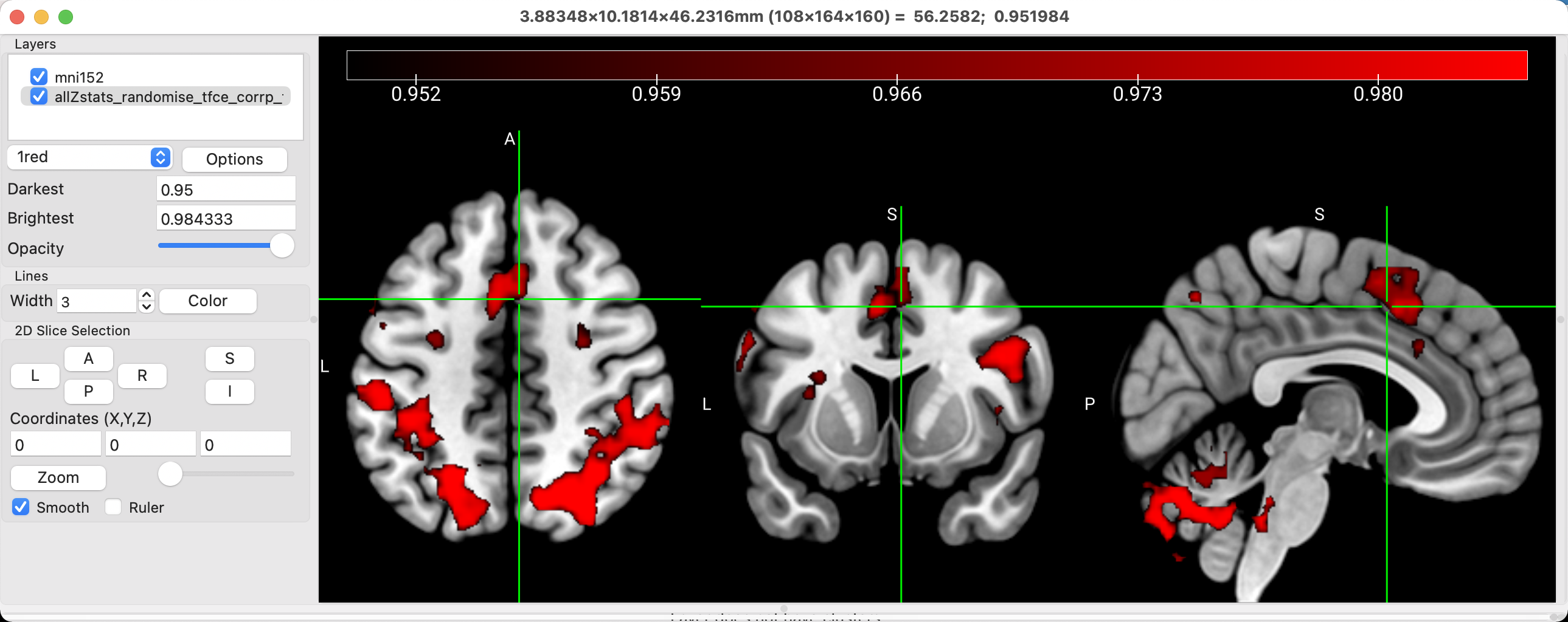 ../_images/04_NeurologicalConvention.png