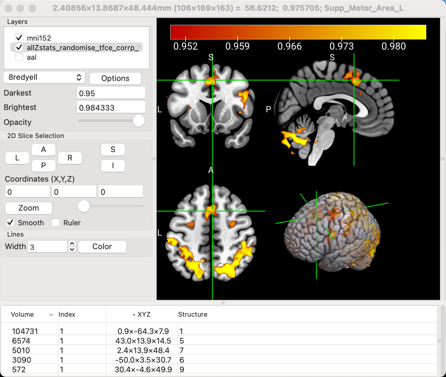 ../_images/04_OrthoRender.png