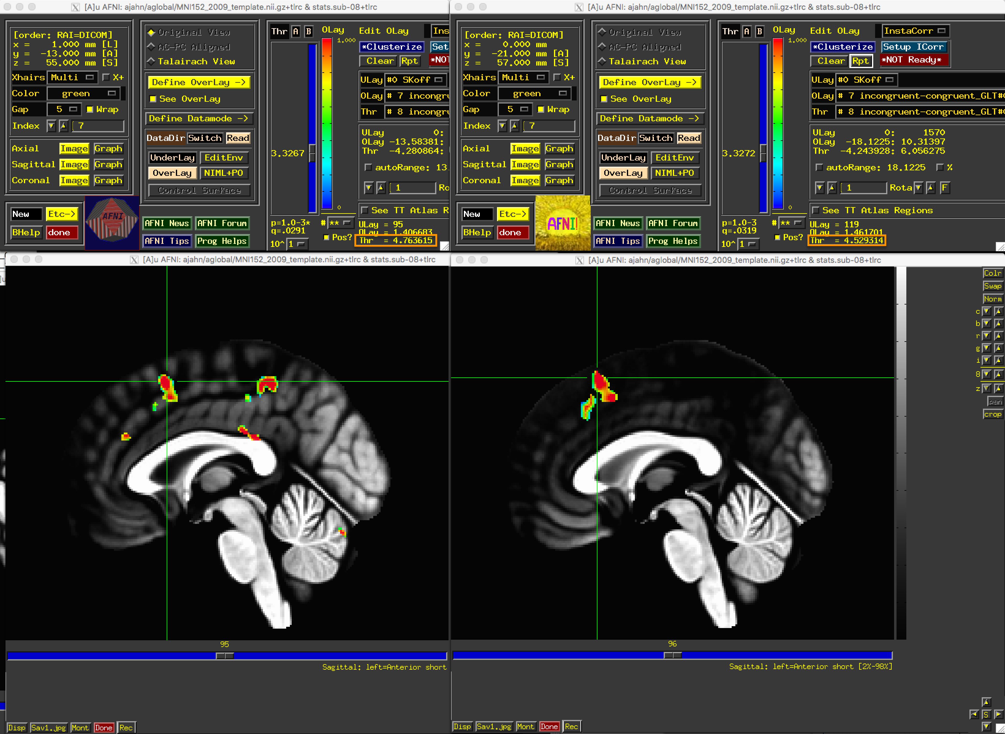 ../../_images/05_1stLevel_Comparison.png