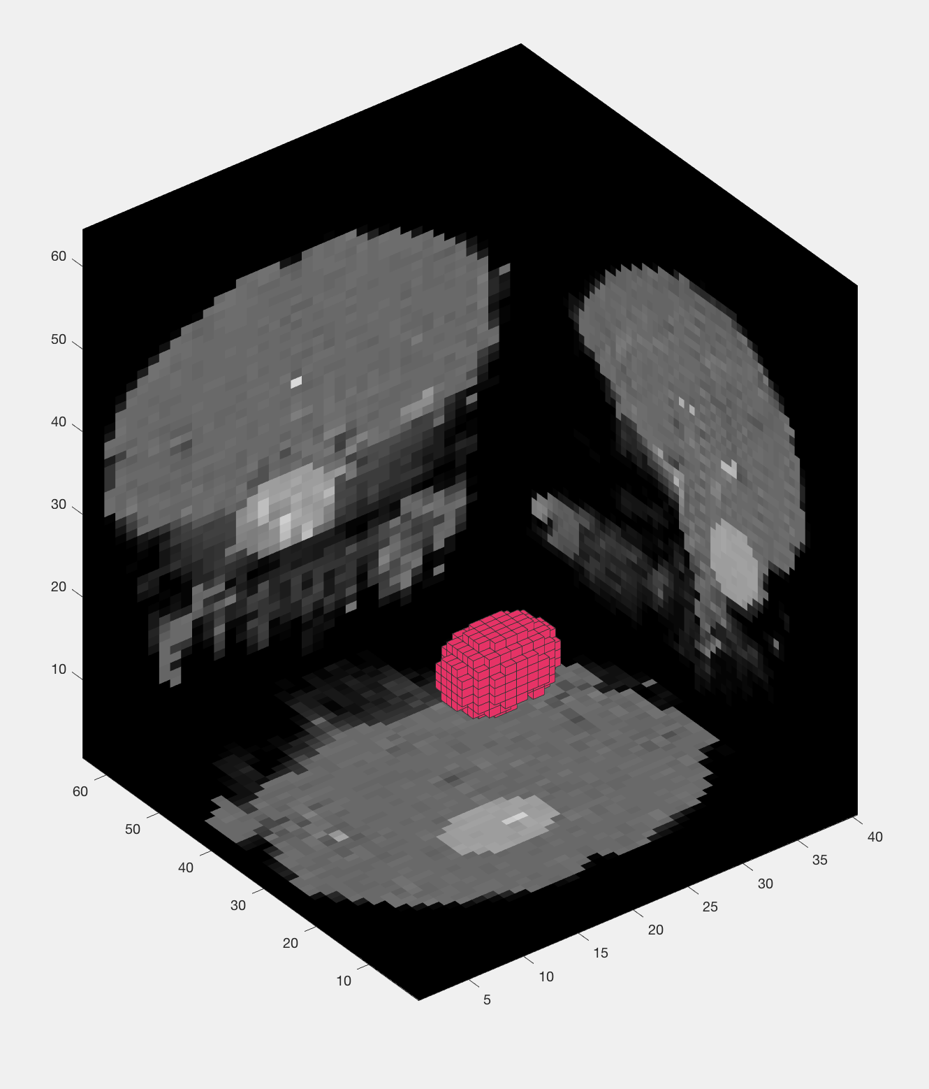 ../../_images/05_Haxby_Searchlight.png