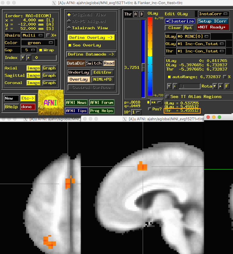 ../../_images/06_GroupResults_AFNI.png