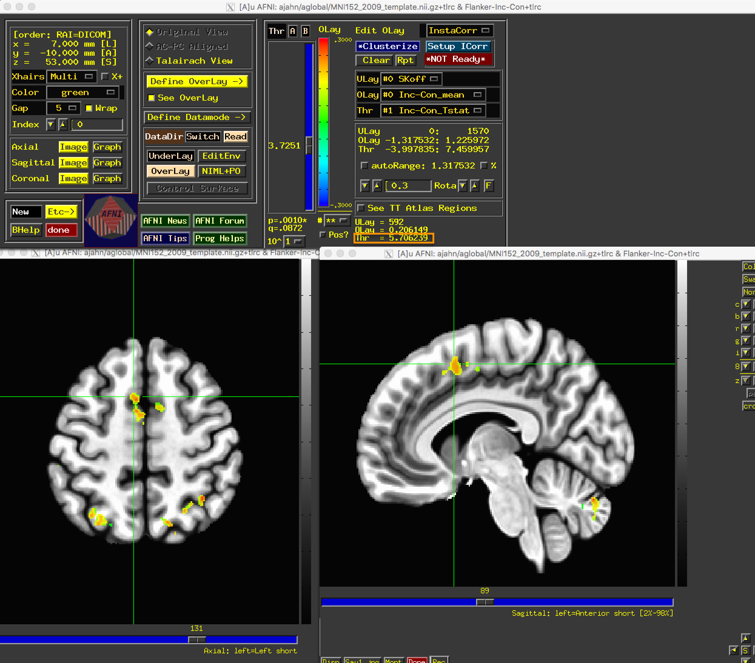 ../../_images/06_GroupResults_fMRIPrep.png