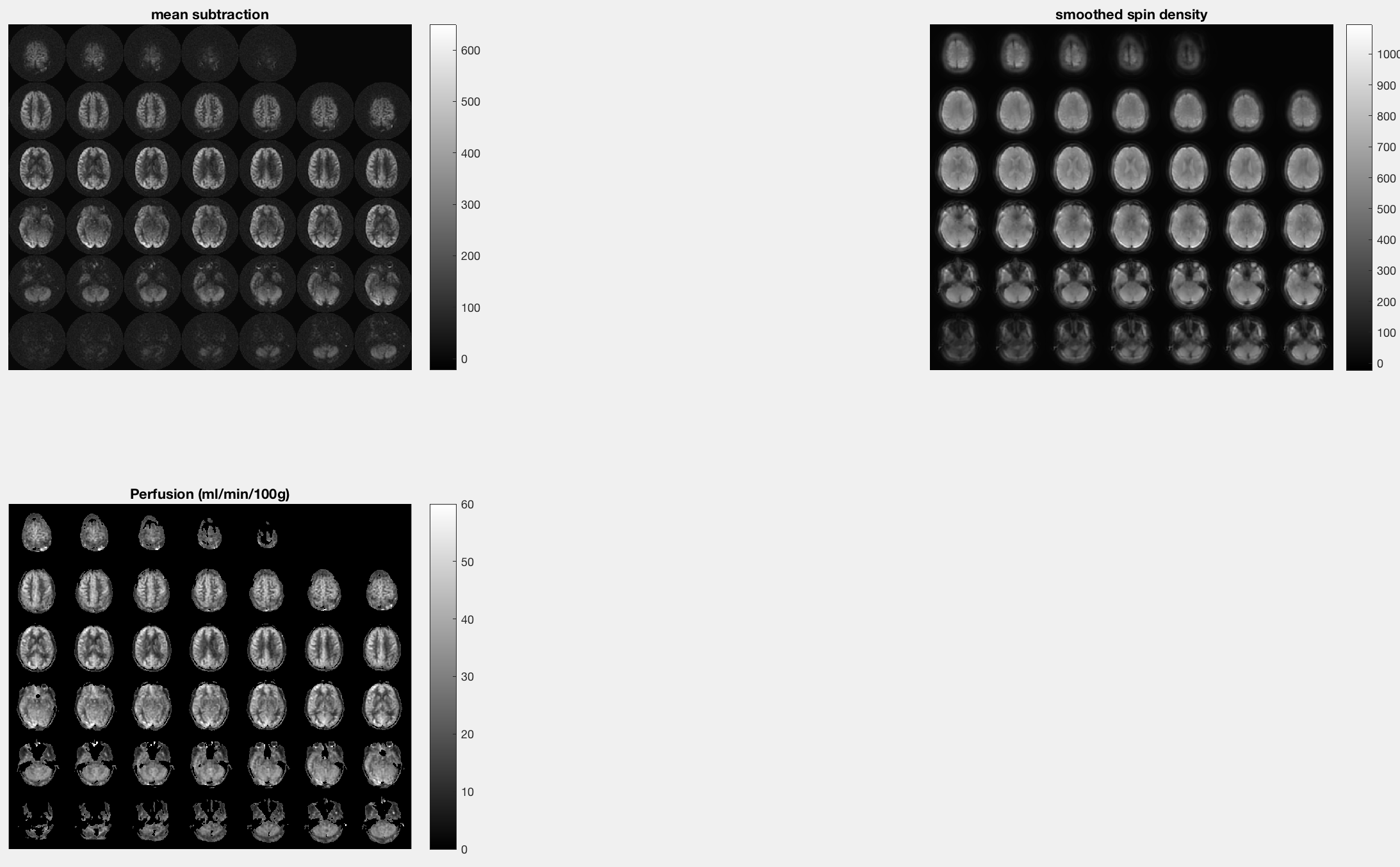../_images/06_Perfusion_Lightbox.png