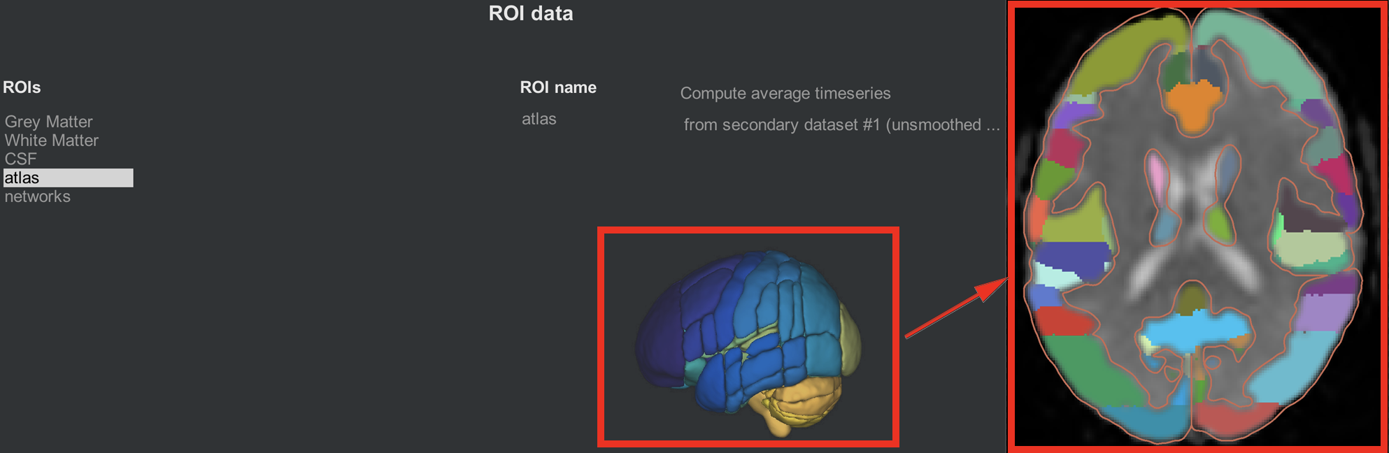 ../../_images/06_ROI_Atlas.png