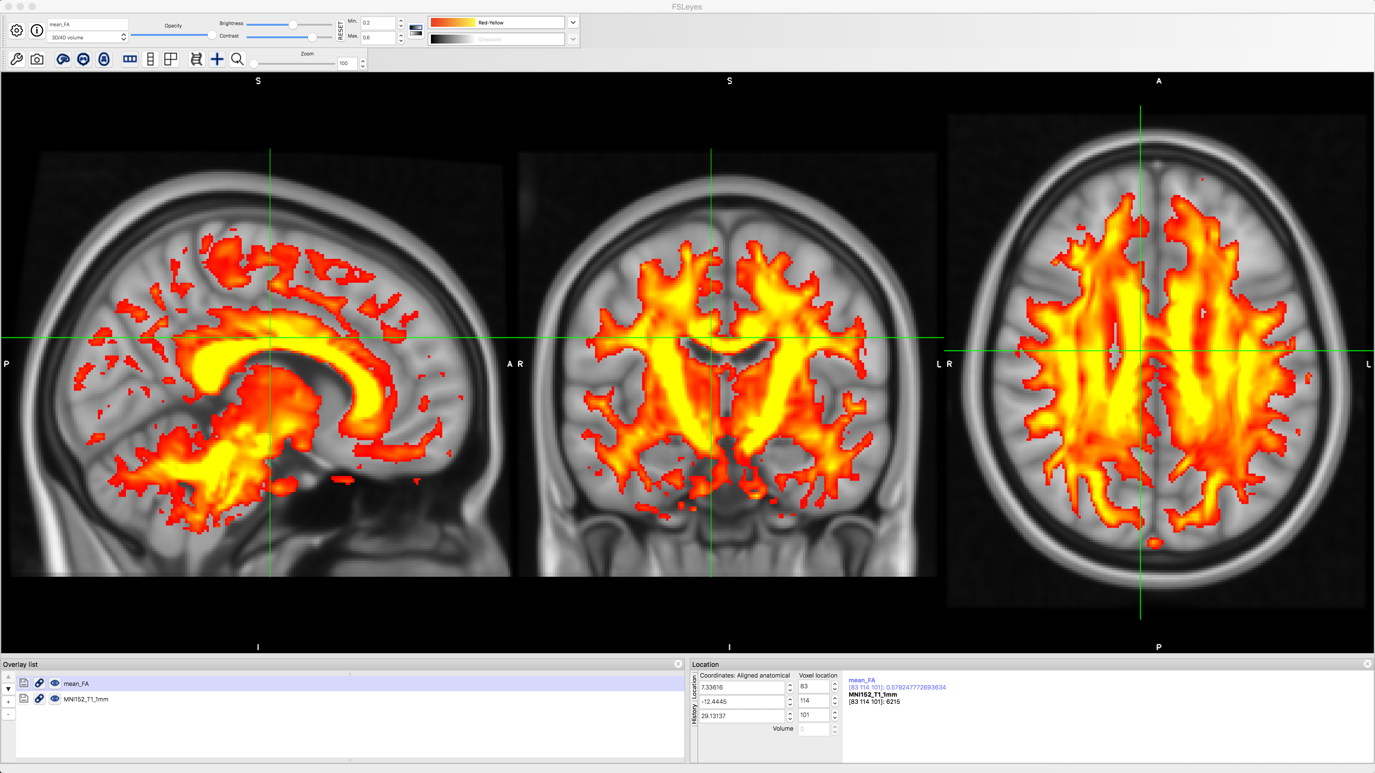../../_images/06_mean_FA_overlay.png