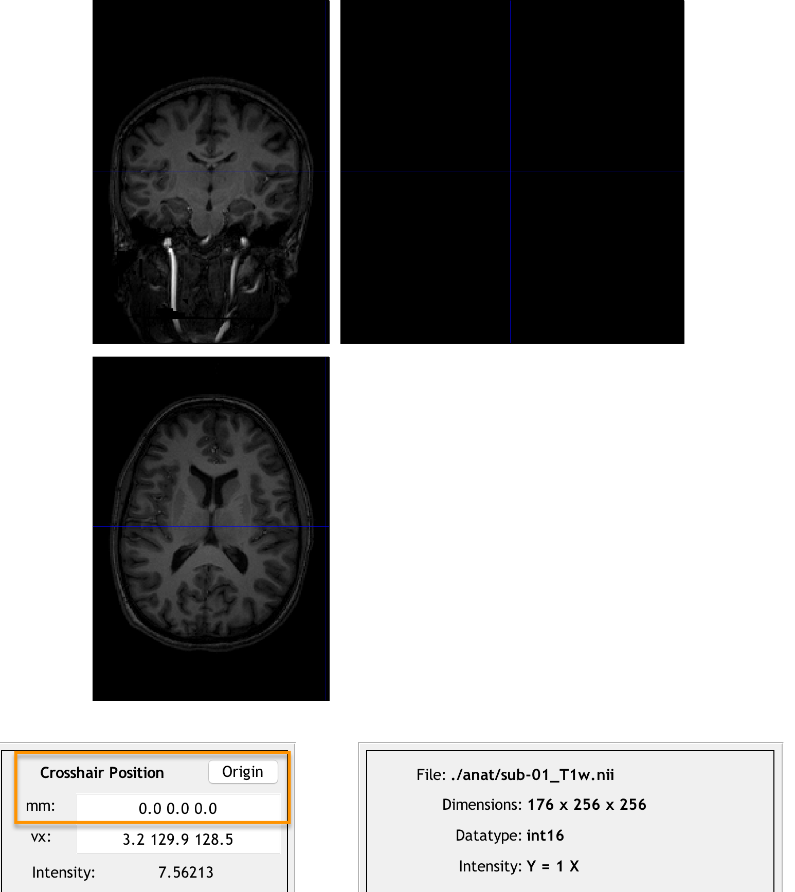 ../../_images/07_Anatomical_Origins_Before.png