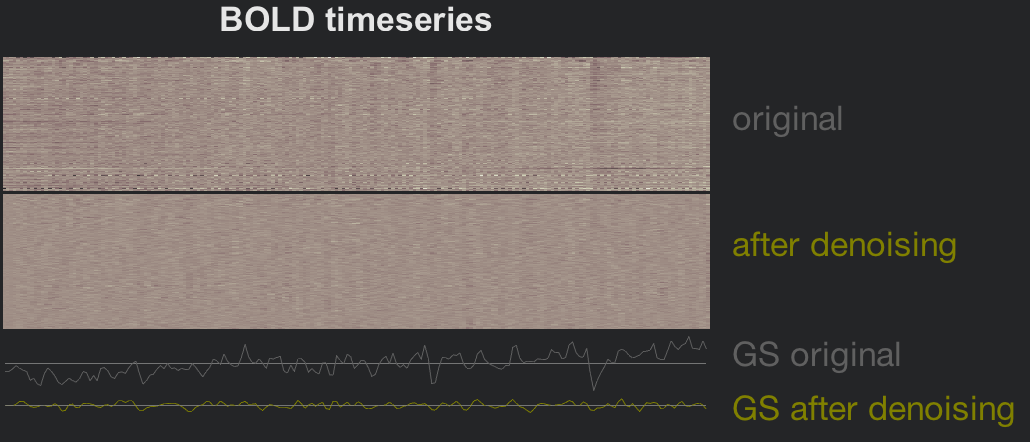 ../../_images/07_BOLD_Timeseries.png