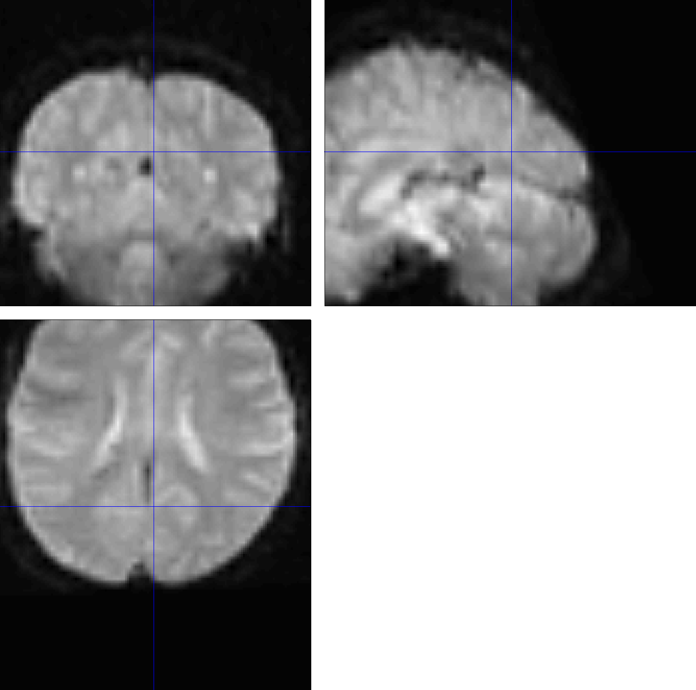 ../../_images/07_NormalizationError_Functional.png