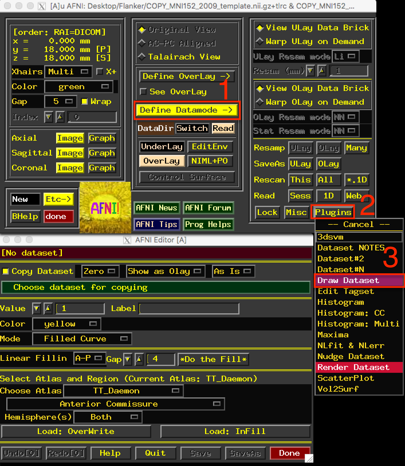 ../../_images/08_DrawDataSetWindow.png