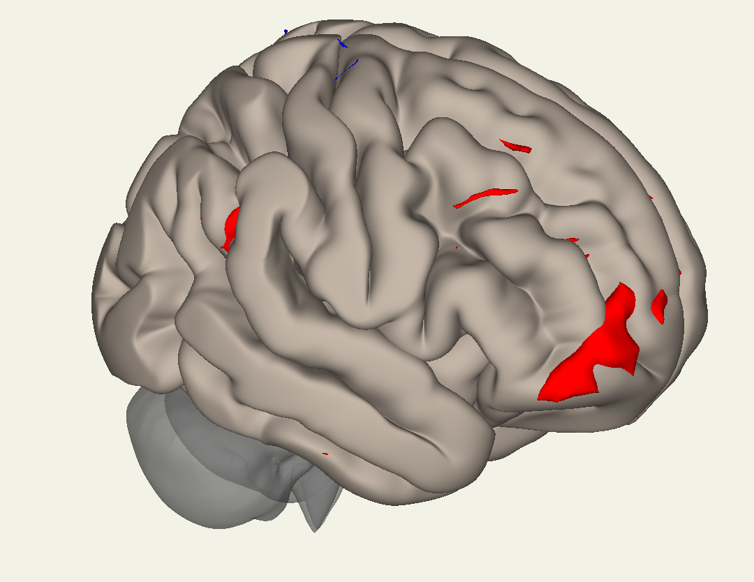 ../../_images/10_Cortical_Results.png