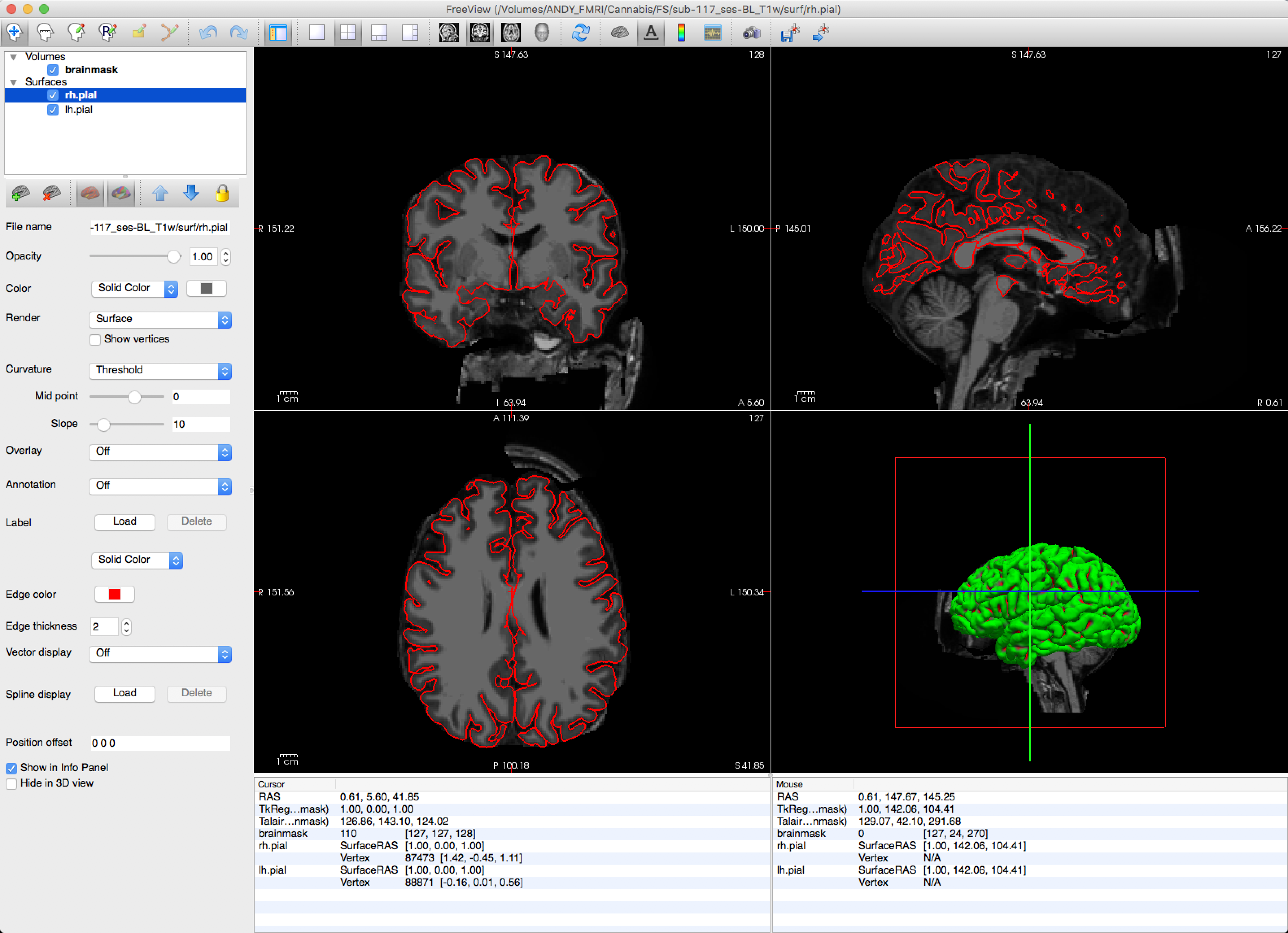 ../../_images/13_sub117_Skull.png