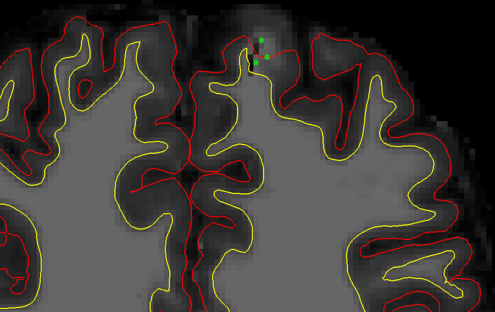 ../../_images/14_ControlPoints.png