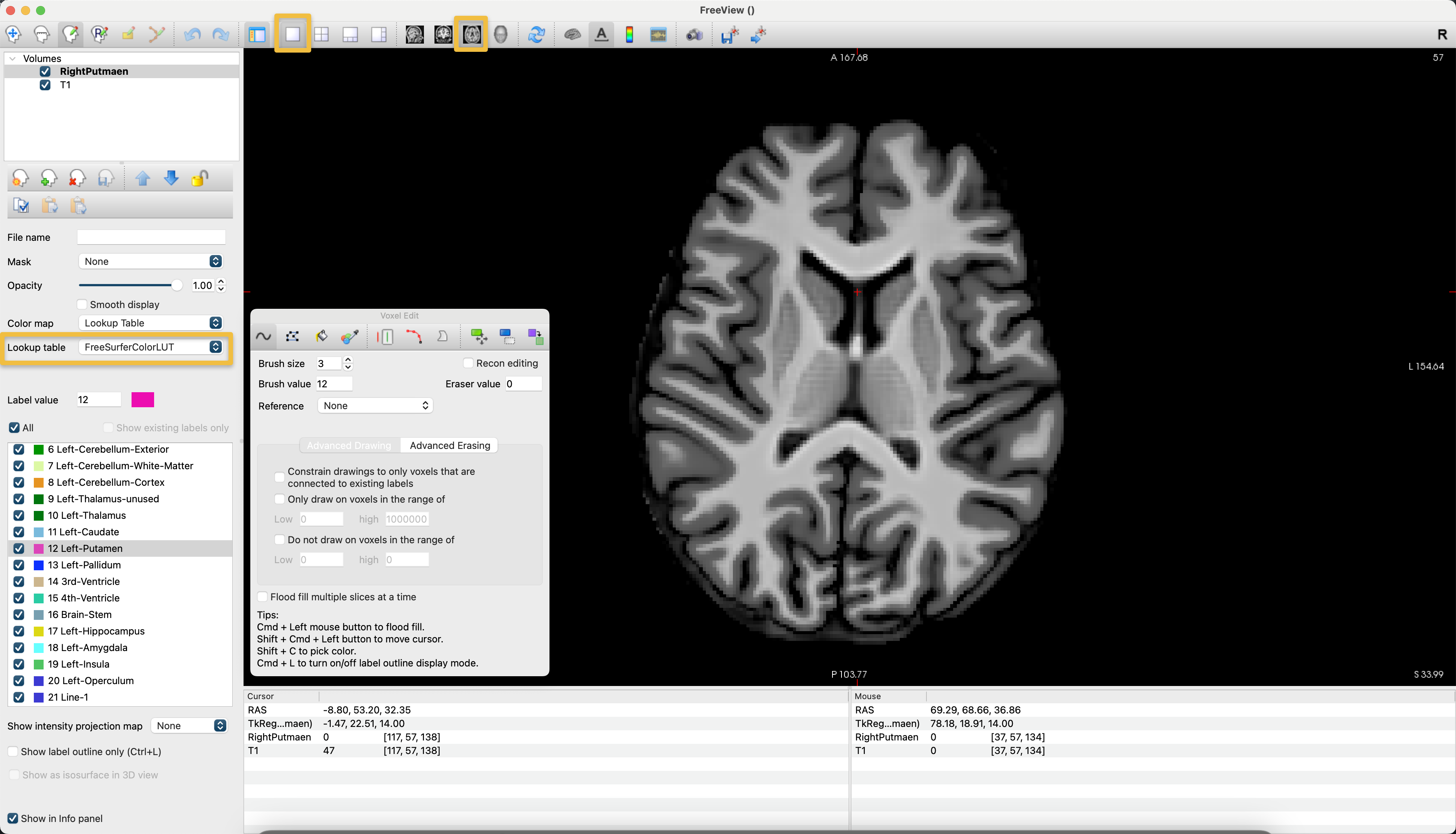../../_images/AppendixC_AxialView.png