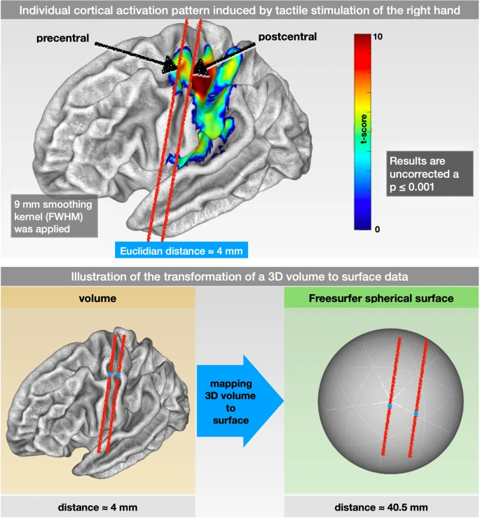 ../../_images/AppendixD_Brodoehl_Figure1.png