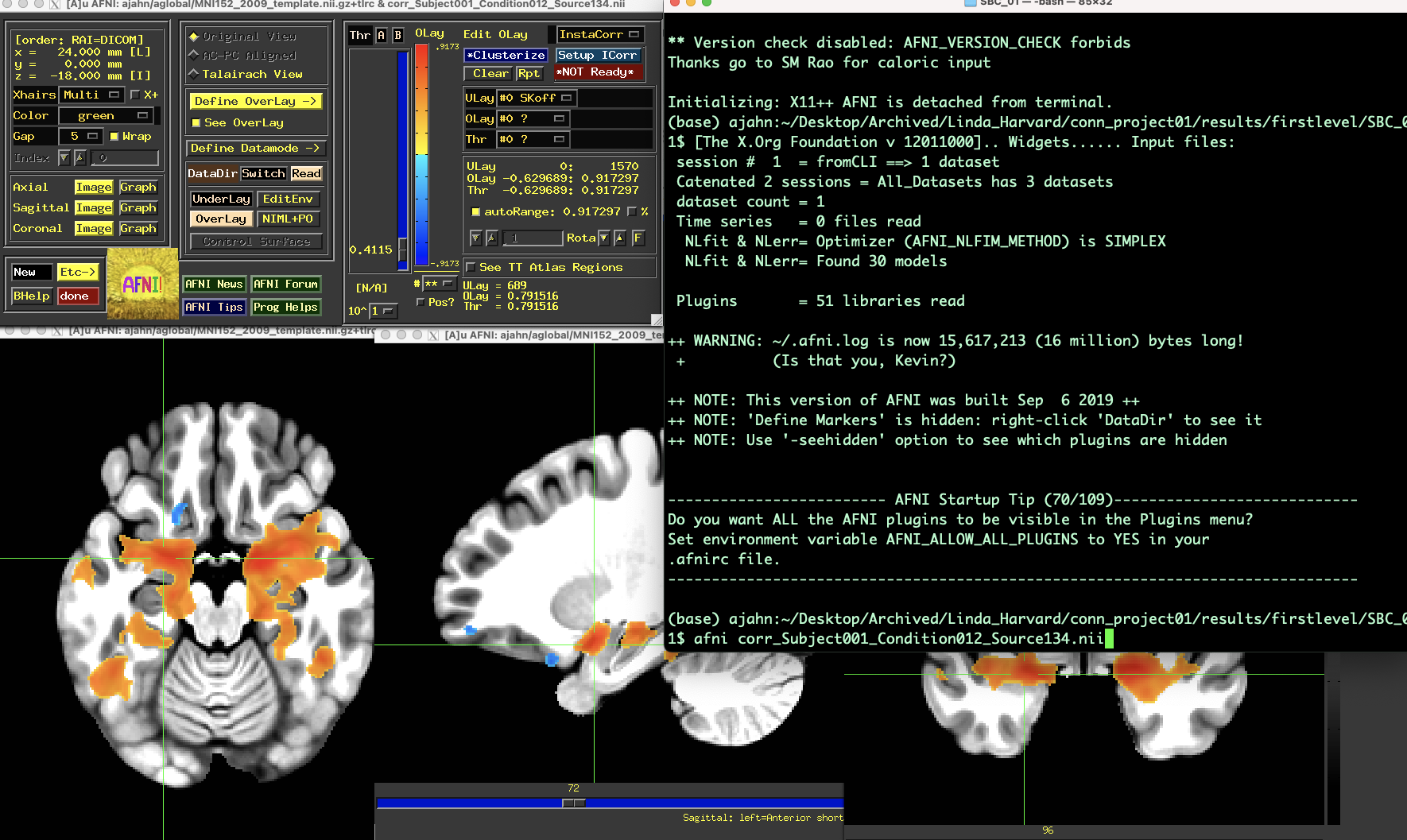 ../../_images/AppendixE_ViewingResultsAFNI.png