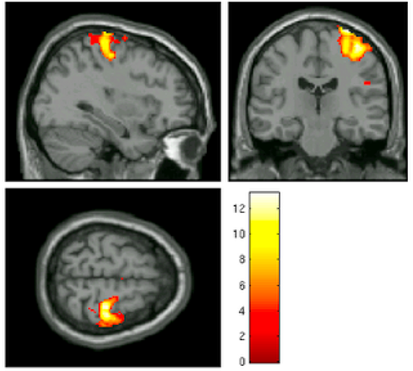 ../../_images/AppendixG_MotorActivity.png