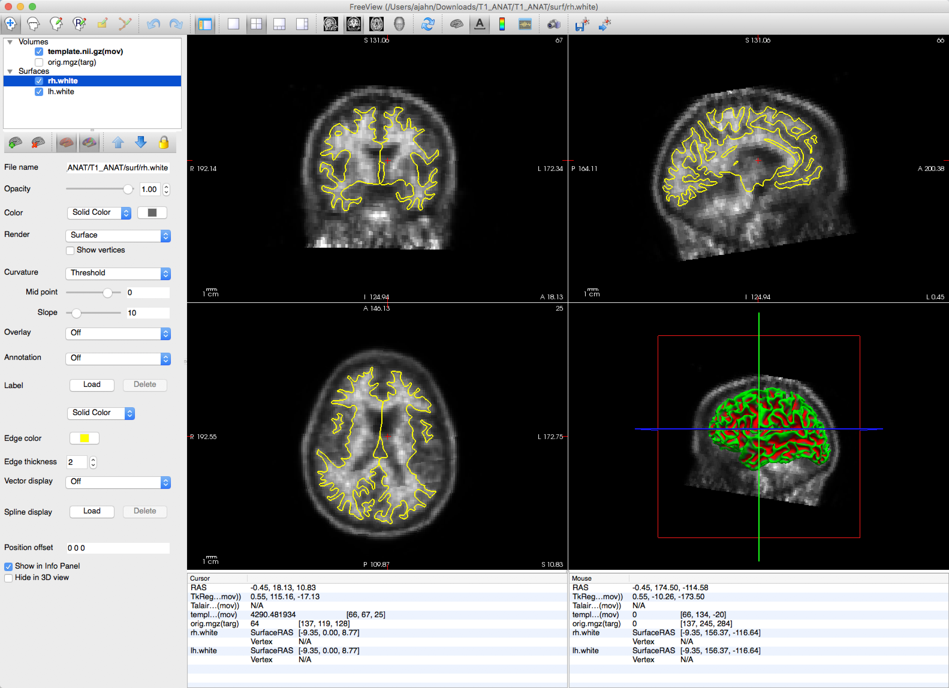 ../../_images/Appendix_B_coregistration.png