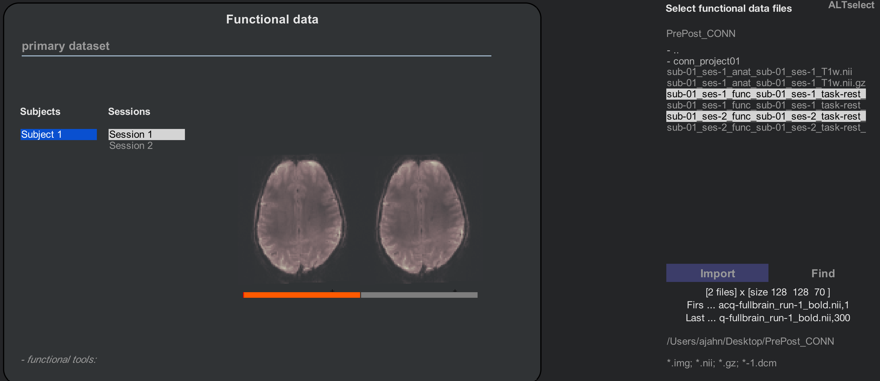 ../../_images/B_Functional_prepost.png