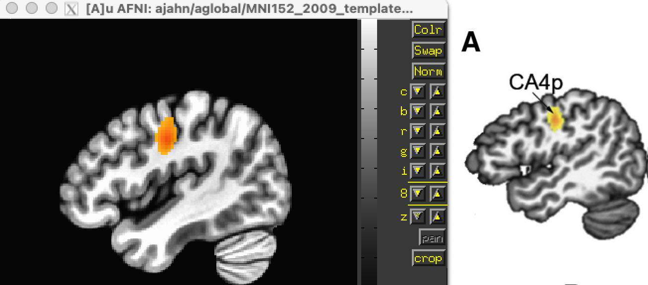 ../../_images/GingerALE_01_Kumar_Replication.png