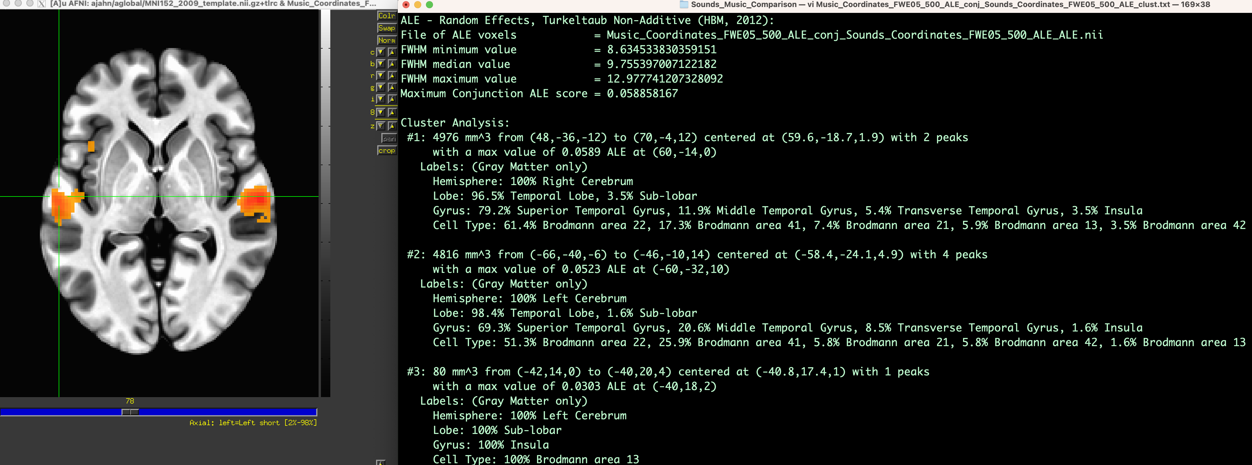 ../../_images/GingerALE_01_ViewingOutput.png