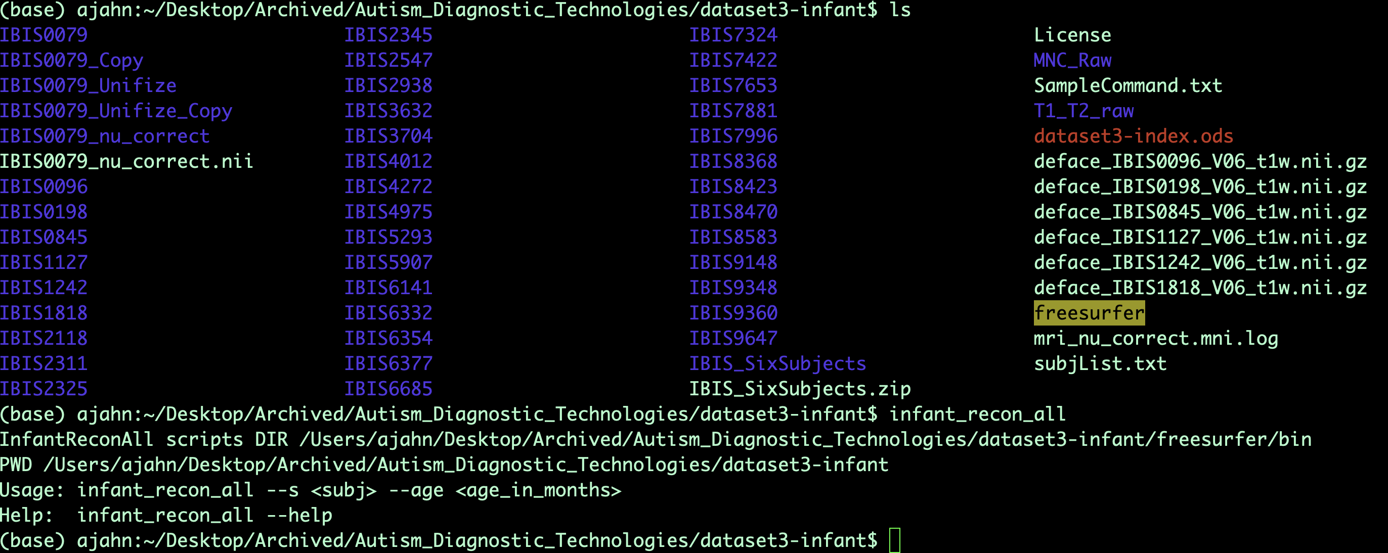 ../../_images/ITK-SNAP_01_infantRecon.png