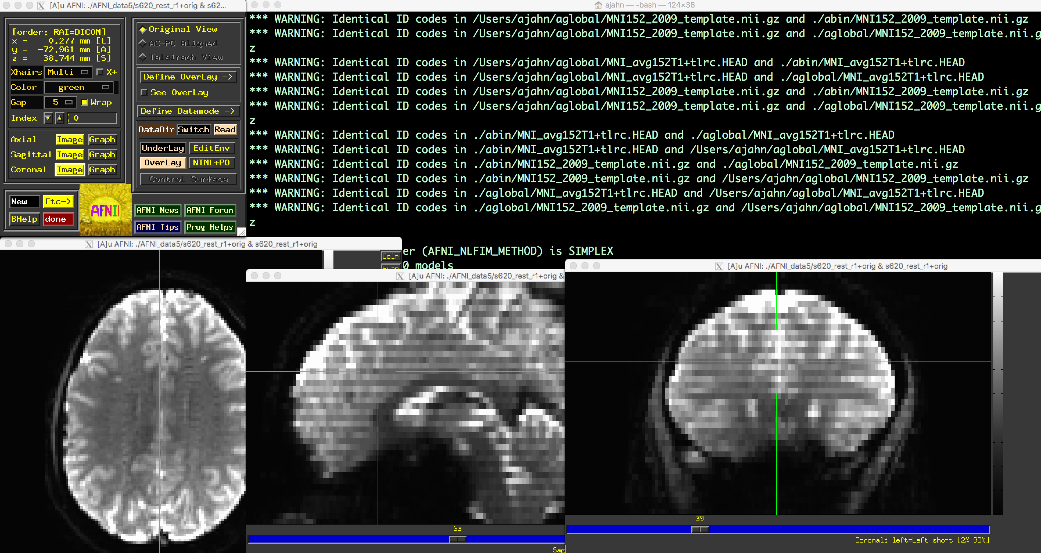 ../../_images/Intro_AFNI_GUI.png
