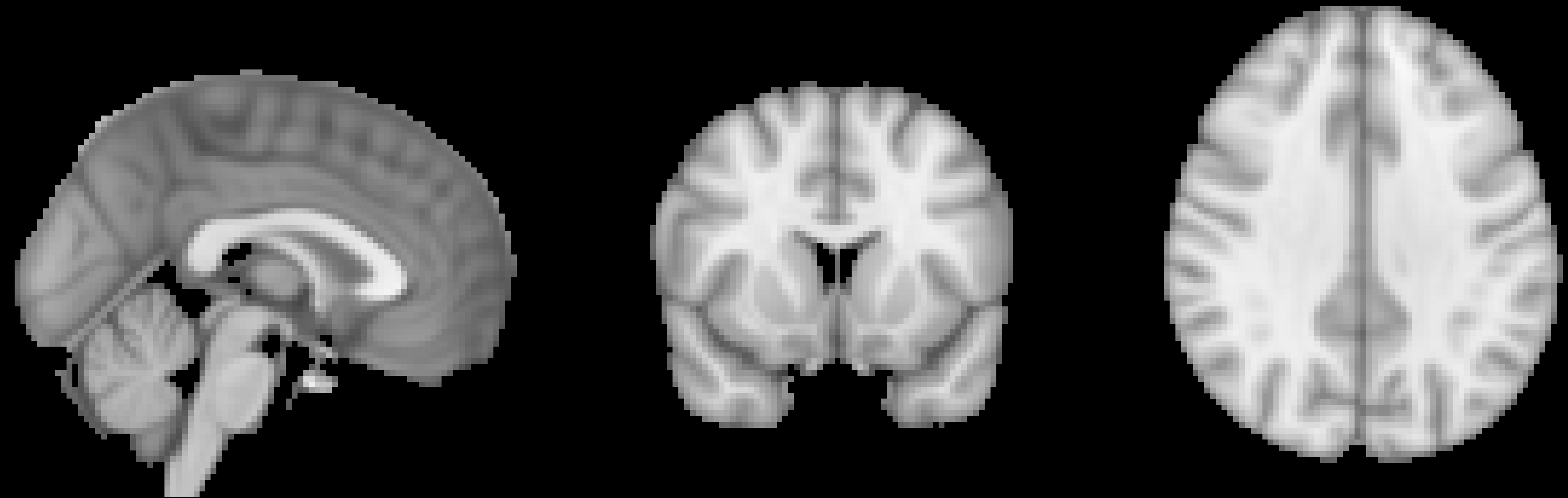 ../../_images/MNI_Template.png